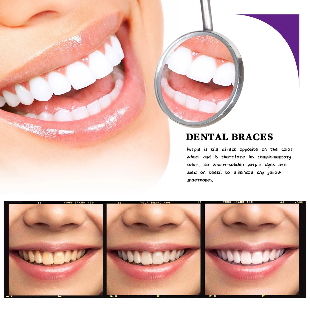 Transform Your Smile with V34 Teeth Whitening Toothpaste - 30ml Intensive Stain Remover for Yellow Teeth and Fresh Breath